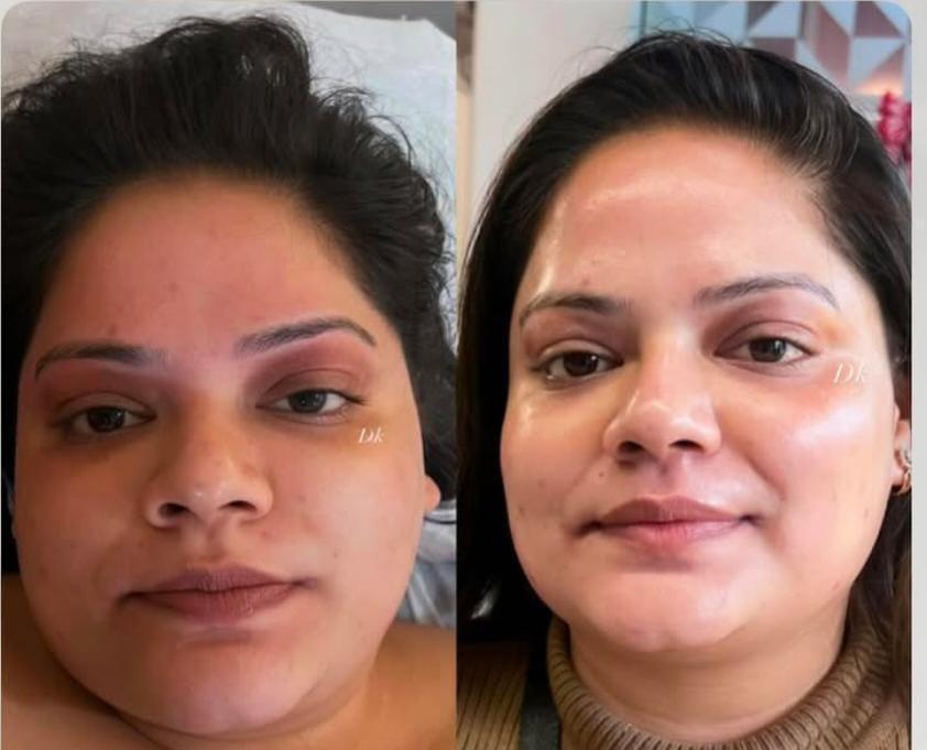 Eyelash Extensions