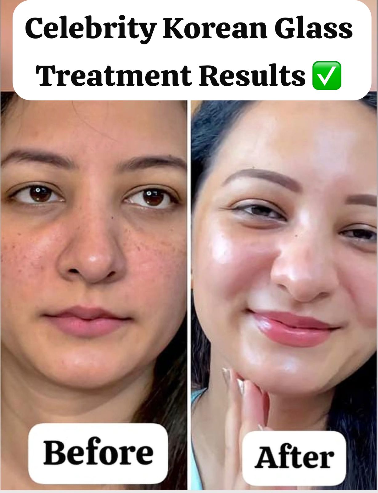 Facial